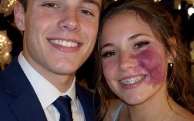Only one boy asked me to prom because no one else wanted to go with me because of the birthmark on my face — everyone laughed until police officers walked into the gym.
